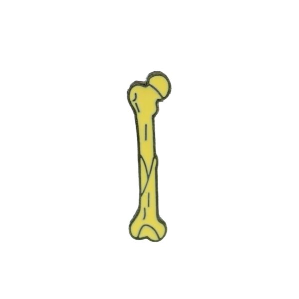 Tibia 3 Pin Fémur Fracturado